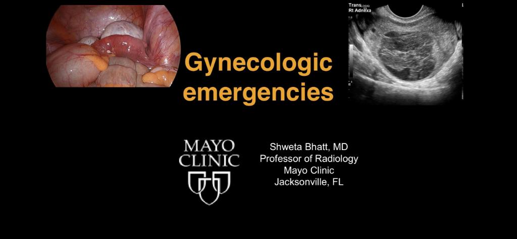 Body Imaging Fellowship at Mayo Clinic in FL (@mayoflbodyimg) on Twitter photo #SAR2021 attendees, check out <a href="/sbhatt1516/">Shweta Bhatt</a> & Dr. Metcalfe's On-Demand Workshop on Gynecologic emergencies prior to the mtg, then attend the expert panel discussion on 3/24 at 3:25pmCST #MayoClinicFL <a href="/MayoRadiology/">Mayo Clinic Radiology</a> <a href="/MayoFL_RadRes/">Mayo Clinic Radiology Residency Florida</a> <a href="/SAR_RFS/">SAR Resident and Fellow Section</a> @SocAbdRadiology #SAR2021 attendees, check out <a href="/sbhatt1516/">Shweta Bhatt</a> & Dr. Metcalfe's On-Demand Workshop on Gynecologic emergencies prior to the mtg, then attend the expert panel discussion on 3/24 at 3:25pmCST #MayoClinicFL <a href="/MayoRadiology/">Mayo Clinic Radiology</a> <a href="/MayoFL_RadRes/">Mayo Clinic Radiology Residency Florida</a> <a href="/SAR_RFS/">SAR Resident and Fellow Section</a> @SocAbdRadiology