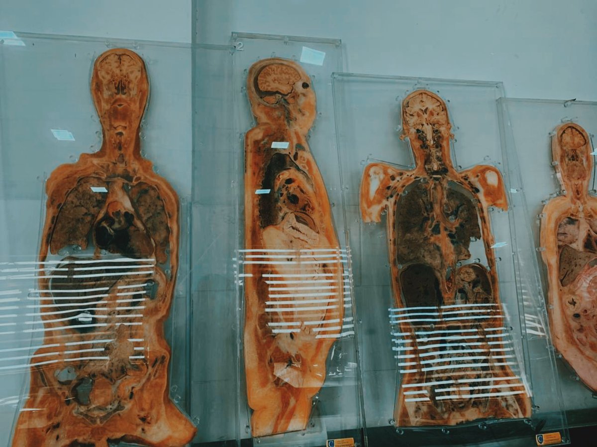 ErevanEssa's tweet photo. #anatomy 
#cadavers https://t.co/BJfcUe3c4Q