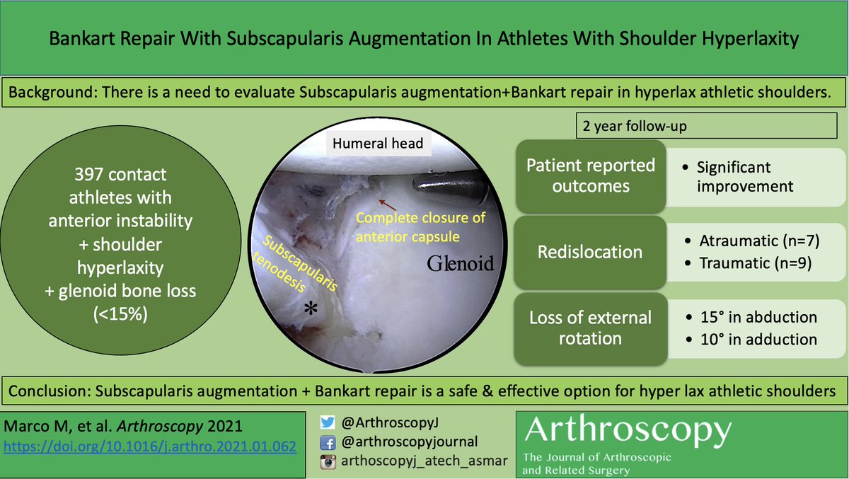 Bankart Repair With Subscapularis Augmentation In Athletes With Shoulder Hyperlaxity @russo_md, @TulaneMedicine ow.ly/awBm50DVmP2