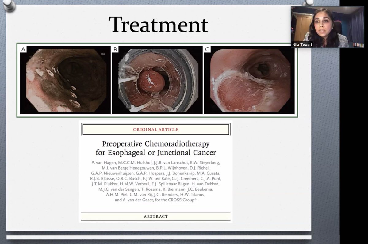 <a href="/NTewari/">Nilanjana</a> giving an excellent talk on SCC of the oesophagus on tonights Roux Group OG Cancer Webinar.