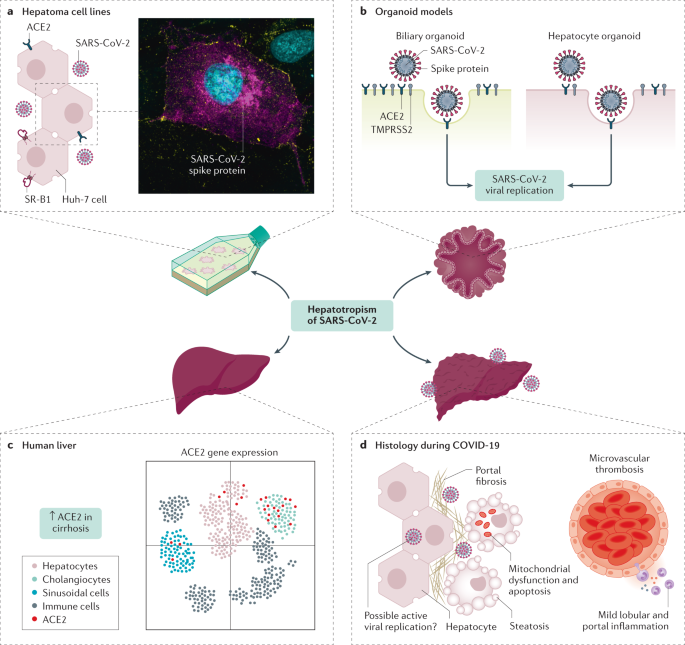 New content online: COVID-19 and liver disease: mechanistic and clinical perspectives dlvr.it/RvN4pM