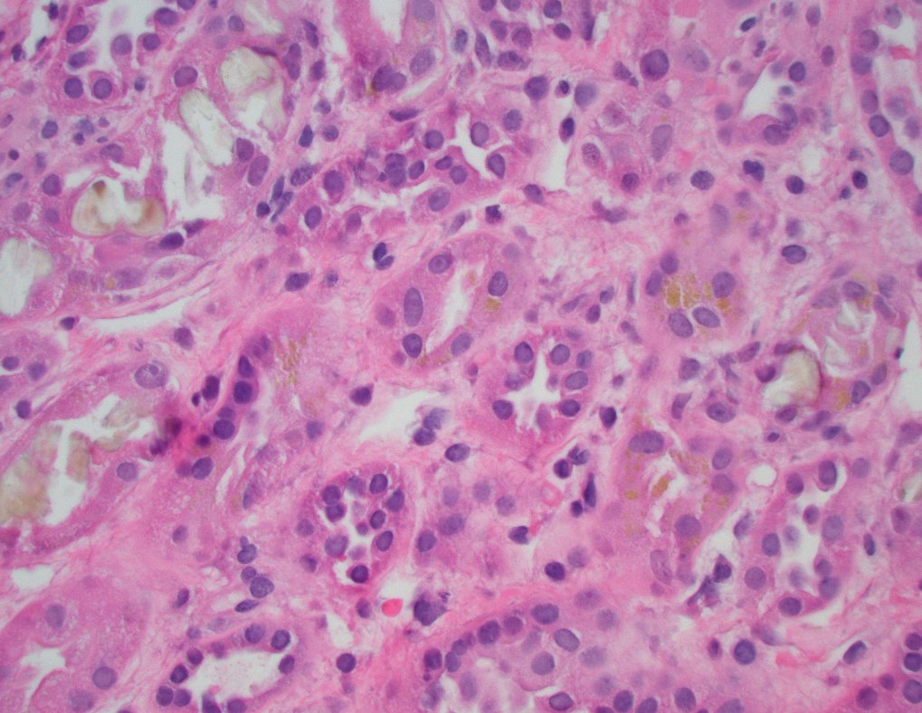 Jonathan Zuckerman MD PhD tweet media