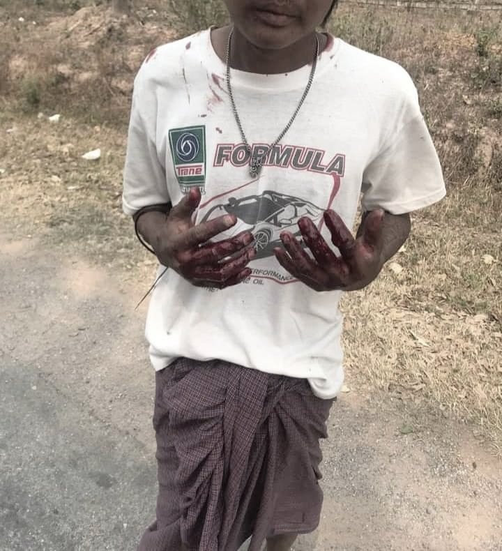 DandanieMyanmar's tweet photo. tw//Violence //Blood //Gunshots
In #Loikaw police terrorists arrested the young man &amp; staright shot him 11 times with rubber bullets &amp; most of the bullets are still in his back &amp; also kicked him with their feet in boots. 

STOP ONSLAUGHT

#WhatsHappeningInMyanmar
#Mar11Coup
©®pic https://t.co/q7EMJ9SaZH