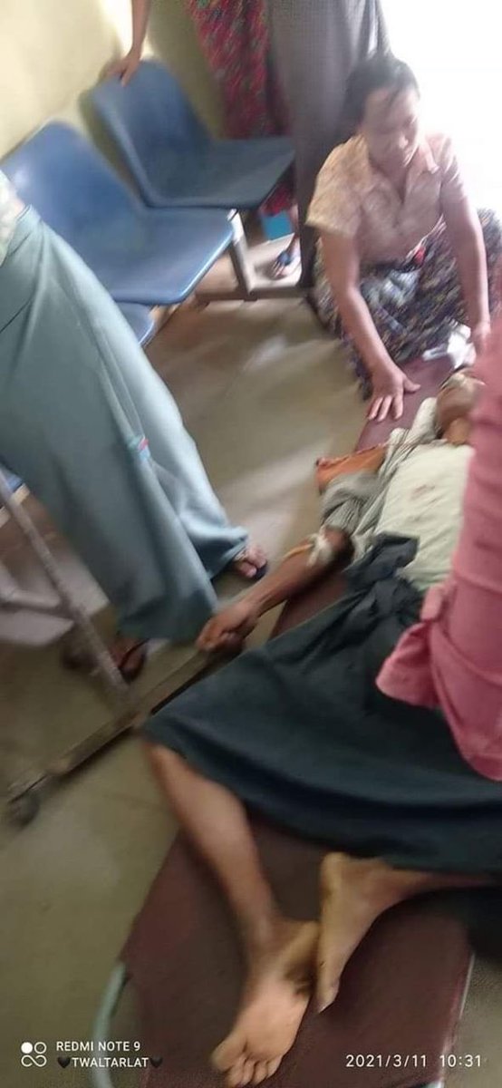 sansan_ss's tweet photo. Tw//blood
📍Magway,Myaing 

Shot with real bullets and tear gases 

One man died as far as we know 
And ppl got injured 

Crd 

STOP ONSLAUGHT

#WhatsHappeningInMyanmar
#Mar11Coup https://t.co/9V5gS1m2mr