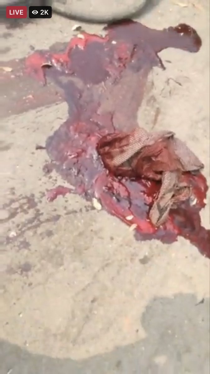 shunee (@shuneella) on Twitter photo TW// Blood
Myaing( small town); Terrorist junta seized the two young civilians who are in the monastery as volunteers at about 9 am. They cracked down the peaceful demonstrators and used both rubber and live bullets.
#WhatsHappeningInMyanmar #Mar11Coup <a href="/RapporteurUn/">UN Special Rapporteur Tom Andrews</a> TW// Blood
Myaing( small town); Terrorist junta seized the two young civilians who are in the monastery as volunteers at about 9 am. They cracked down the peaceful demonstrators and used both rubber and live bullets.
#WhatsHappeningInMyanmar #Mar11Coup <a href="/RapporteurUn/">UN Special Rapporteur Tom Andrews</a>