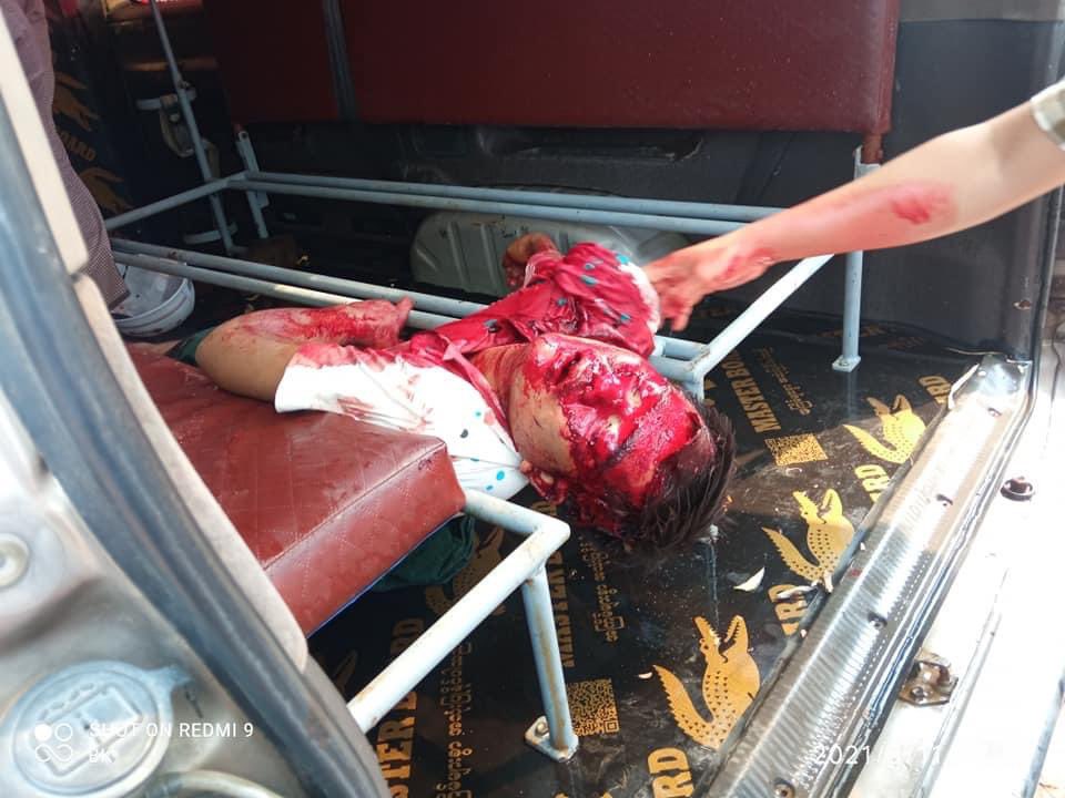 hannayuri_twt's tweet photo. Tw// blood 
In Myaing,Magway 🚨🚨🚨 

STOP ONSLAUGHT
#WhatsHappeningInMyanmar
#Mar11Coup https://t.co/LjNjeMmWmK