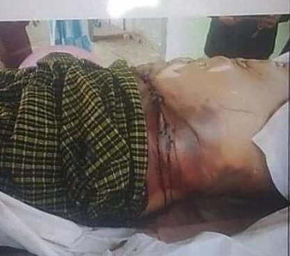 ASW71796182's tweet photo. @UNGeneva The killing of Ko Zaw Myat Lin, an NLD member from ShwePyiThar was too brutal and gruesome to share. When his family received the body, he no longer has any teeth nor organs. His face and body turned unrecognizable by the torture he received. https://t.co/5h2TQ0ZfJ1