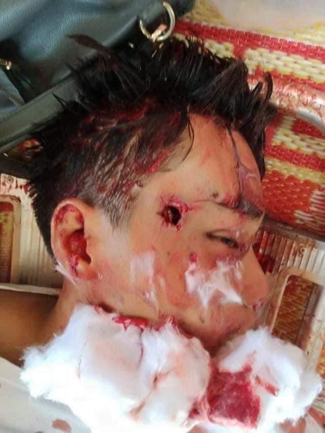 MayOfficial6's tweet photo. TW : Death,Headshot, Blood

Military terrorists shot with live bullets to crackdown the strike in North Dagon! The one who were in the front line protection was shot in the head and passed away on the spot😭😭 Another one was shot in the pubic!
#WhatsHappeningInMyanmar
#Mar11Coup https://t.co/O4uhPKRH8O