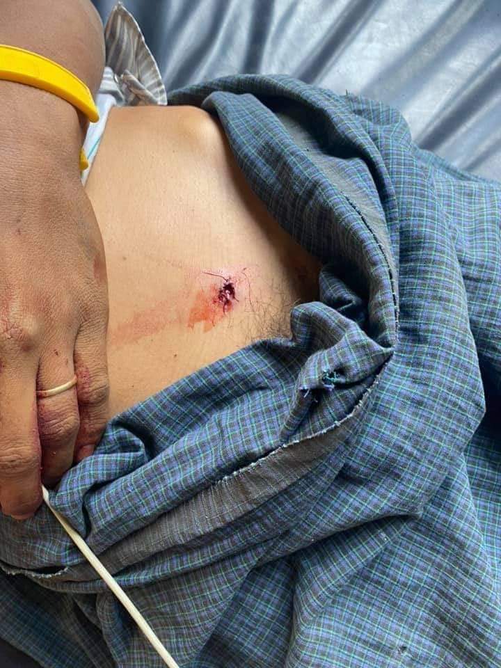 KoKyushi's tweet photo. TW // Blood, violence, Gun violence
They used real bullets🚨🚨
#BREAKING at least six killed, many injured in anti-coup protest in #Myaing Township, #Magway Region today. Peaceful protesters who got shot dead in the head. Brain came out on the street
#WhatsHappeningInMyanmar
@UN https://t.co/I0pW2StQ2q