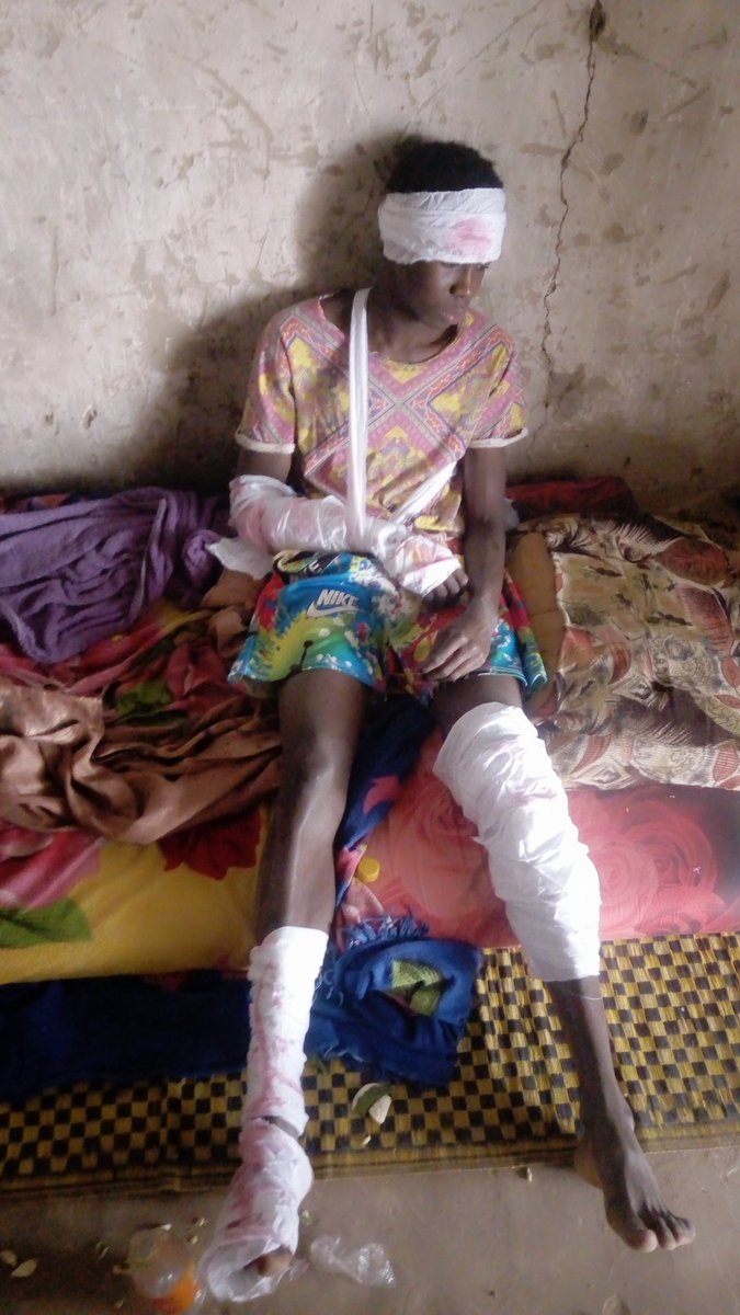 Halima09379852's tweet photo. This happened in a car accident yesterday, so if you wish to help in any kind it will be well appreciated please 🙏 https://t.co/oWsCjVkxZk
