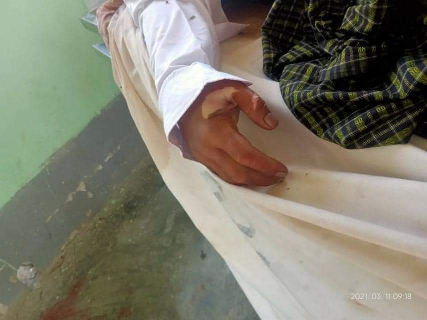 On 8 March,Ko Zaw Myat Lin(Officer-in charge at SU Professional training school) was arrested by the team led by township officer and the military at 1:30am midnight.At 12:30pm noon,his wife was phoned on 9 March to take his dead body.