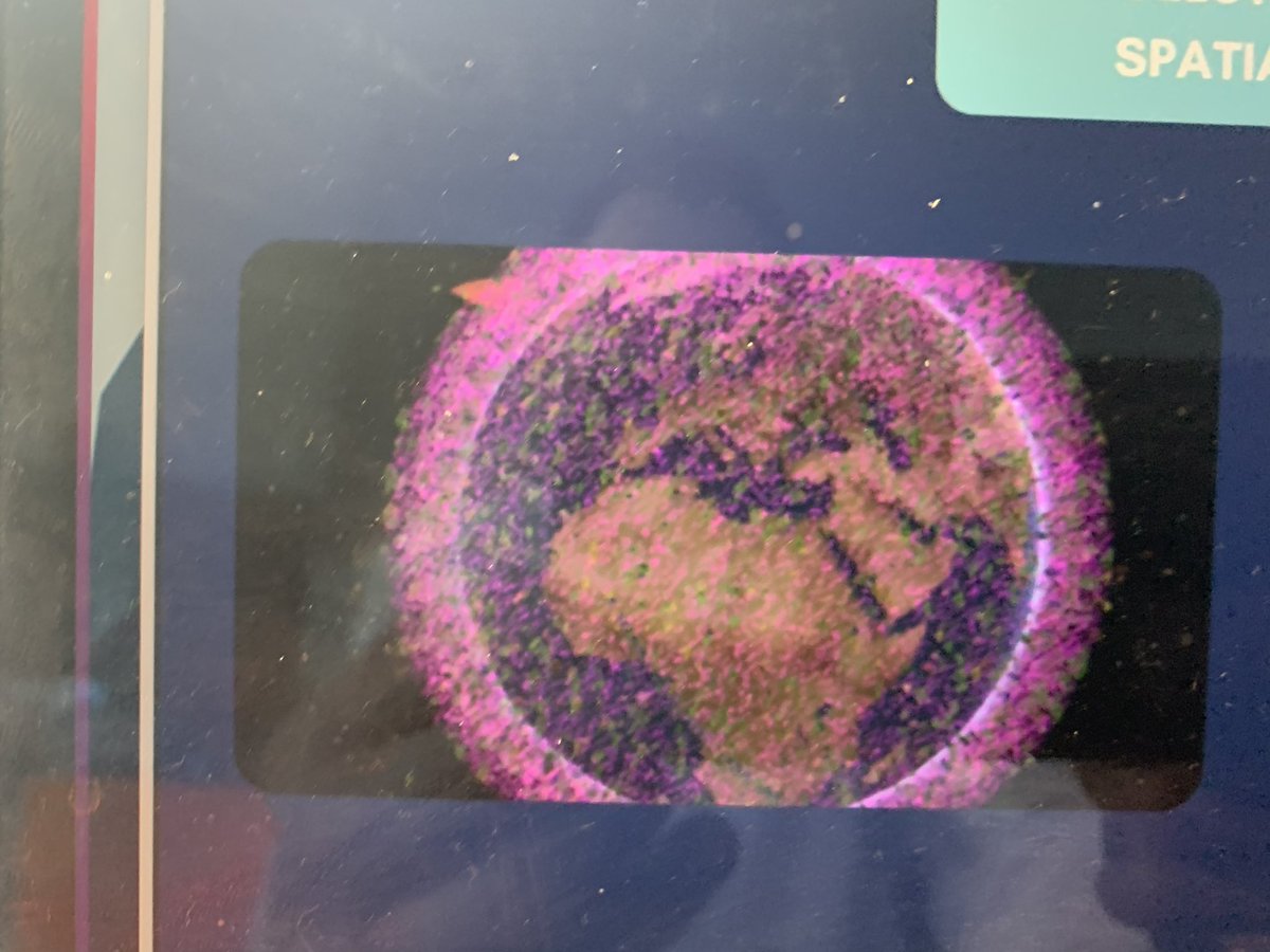 Cette image correspond à la pollution spatiale 😱😱

#x6spacemasterclass #mbadmb