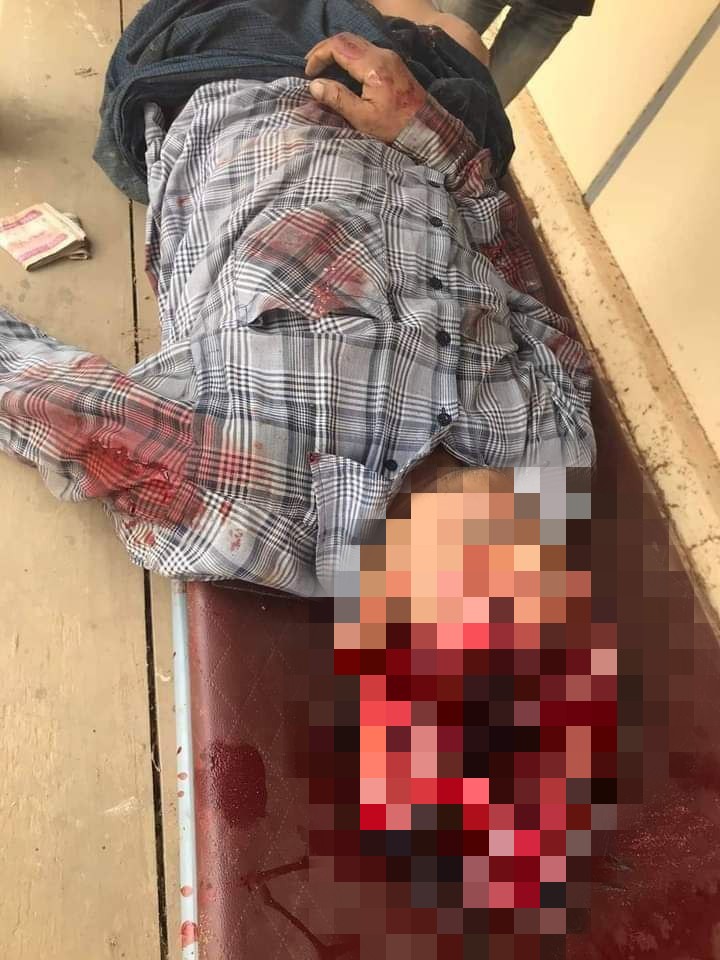 abfsu_cec's tweet photo. TW// Blood and violence 
TW// death
Pro-democracy protestors were shot in Myaing, Magway Division, Burma. Military junta used live bullets and 7 were death at the shot. 

#WhatsHappeningInMyanmar #CrimesAgainstHumanity https://t.co/Lm5YQTRG4S