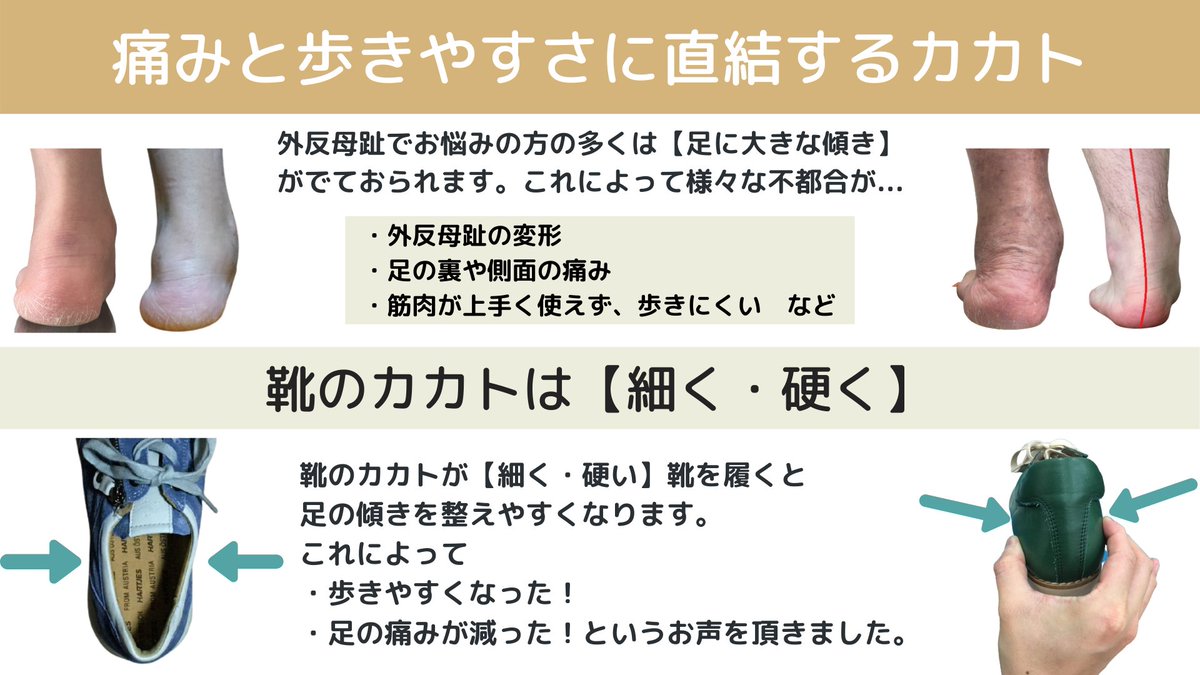 コバ靴店 足トラブルを分かりやすく解説 外反母趾の方が快適な靴を選ぶコツ 当たって痛い部位は 靴屋さんや靴修理屋さんでそこだけ伸ばしてもらうのをおすすめします それだけでも随分と変わりますよ コバ靴店 足トラブルを分かりやすく解説 外反母趾の方が快適な靴を選ぶコツ 当たって痛い部位は 靴屋さんや靴修理屋さんでそこだけ伸ばしてもらうのをおすすめします それだけでも随分と変わりますよ