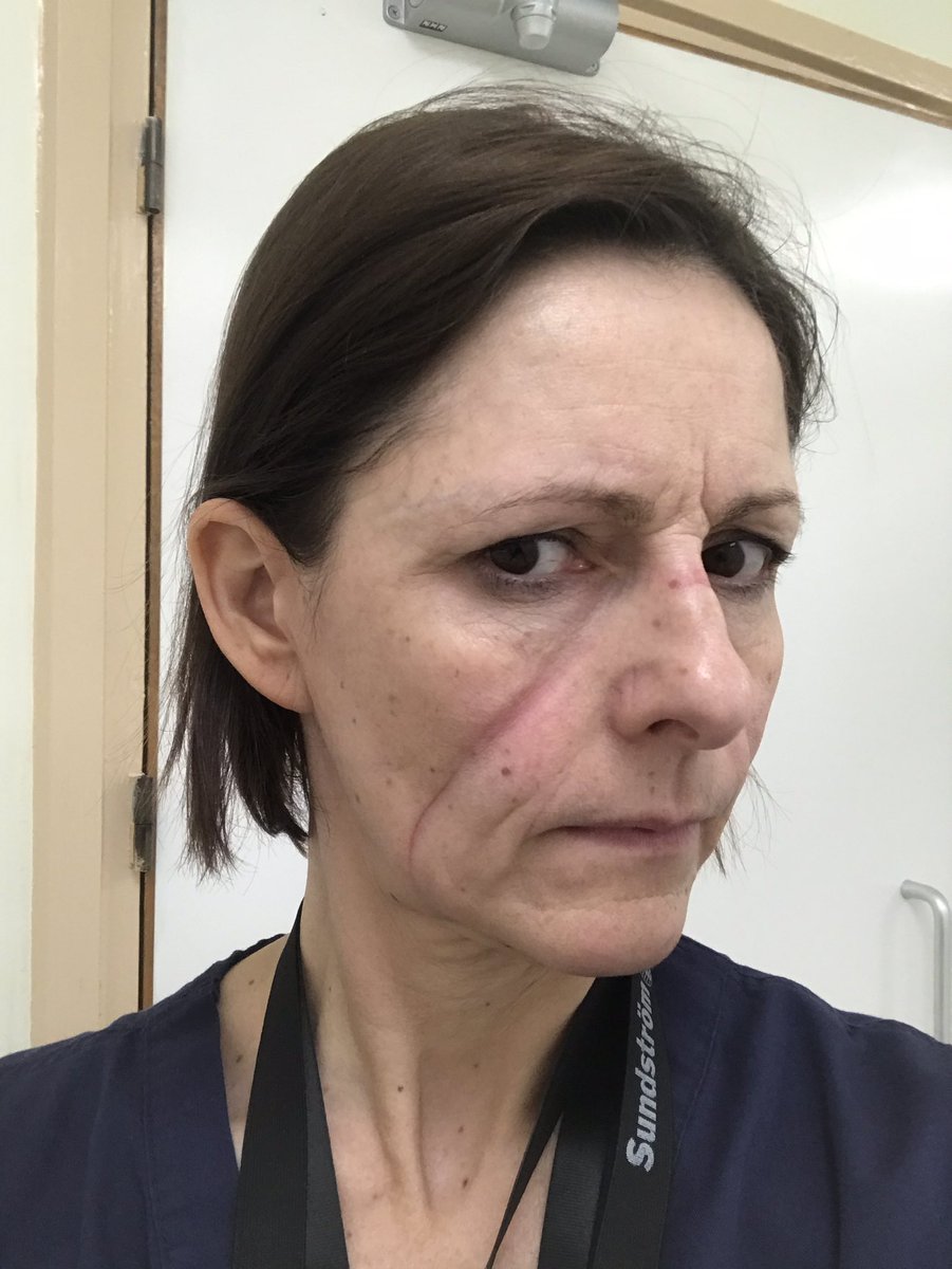 moody1561's tweet image. I have worked on ICU since 94. Looked back at old payslips. Since 2013 my hourly rate has increased by £1.72 The national living wage in the same period has increased by £2.41 How can the government say this is fair #nhs #clapforcarers #nurses #COVID19 #ToryLies #PMQs