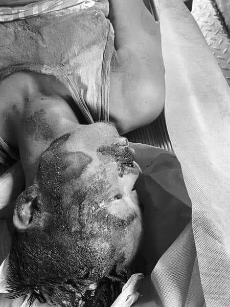 Bloody shooting in Bago; One was shot in head and died n became 9th victim killed only on Mar 11. One street vendor also shot in leg by Min Aung Hlaing’s armed criminals n he is critical condition.

STOP ONSLAUGHT
#Mar11Coup
#WhatsHappeningInMyanmar