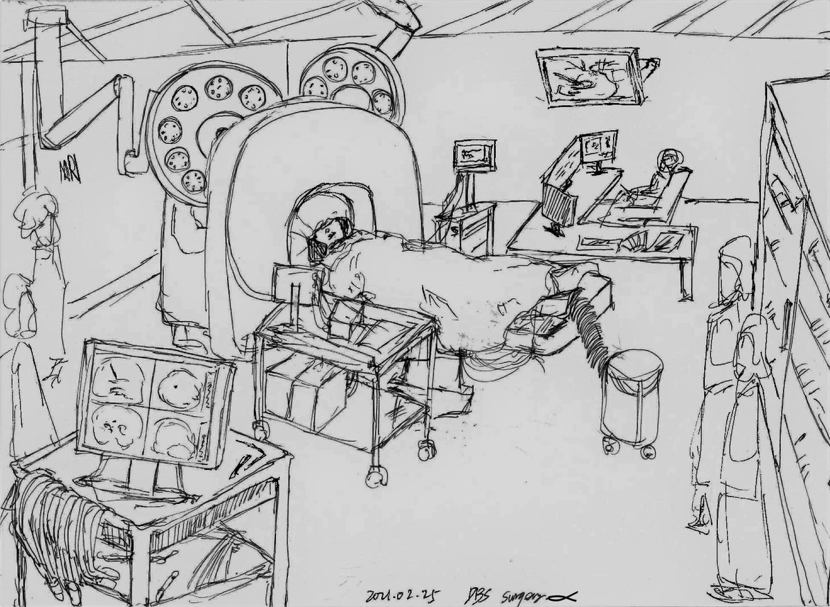 CHECK OUT this BEAUTIFUL sketch, created by Qixiu Fu after her first OR observation of #DBS surgery for treating #ParkinsonsDisease! This is Qixiu's unique way of presenting/remembering her #research. VOTE NOW for #ArtoftheBrain image #6. Most♥️'s wins! <a href="/MountSinaiPsych/">Mount Sinai Psychiatry</a> <a href="/xiaosigu/">Xiaosi Gu</a>