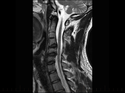 Do you think this 27-year-old male professional player should be allowed to continue to play football (or other contact sport)? If not, why not? #FootballNetwork #FIFADiploma

👉 ow.ly/jT6o50DW8nf