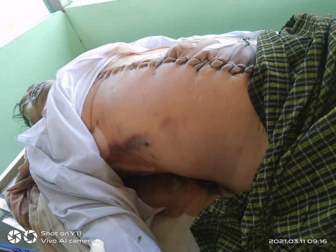 theunderdog68's tweet photo. T/W blood death
NLD member U Zaw Myat Linn was arrested at 3AM, tortured brutally and killed by military junta. 
@UNHumanRights  @UN @freya_cole
#CrimesAgainstHumanity 
#WhatsHappeninglnMyanmar 
#Mar11Coup https://t.co/IINDWZWyYm