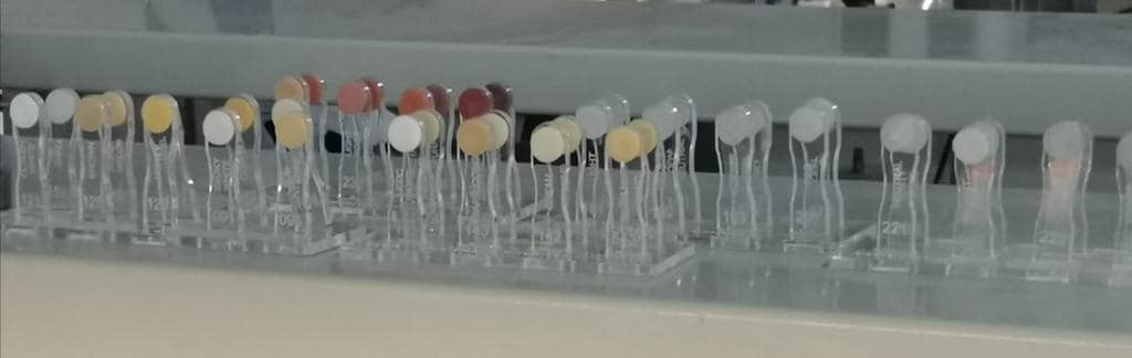 JobesaFormacion's tweet photo. XXX Edición Máster Cerámica Dental de la mano de Barbara Calero.
Curso terminación de materiales CadCam Vita y de Vita LumexAc cerámica de recubrimiento de baja fusión
Un placer J. Carlos Blasco Vita Ibérica por tenerte con nosotros❗ Aprendimos y pasamos dos días estupendos❗ 👏 https://t.co/by2gYxf375