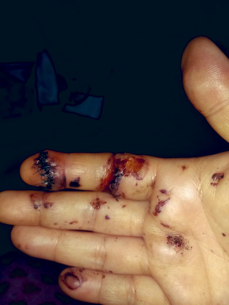 labolchevique's tweet photo. ¿Y entonces no hubo graves violaciones a los derechos humanos?   Ahhh y claro tampoco hubo uso excesivo de la fuerza, verdad? #Batalladel8M21 
#ClaudiaSheinbaum
#GobiernodeMexico
#GOBIERNODELACDMX
#SecretariadeSeguridadPublica https://t.co/Ppe5q1Rfj2