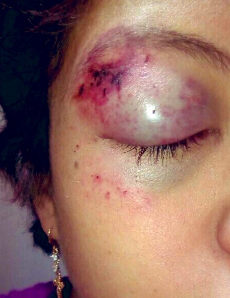 labolchevique's tweet photo. ¿Y entonces no hubo graves violaciones a los derechos humanos?   Ahhh y claro tampoco hubo uso excesivo de la fuerza, verdad? #Batalladel8M21 
#ClaudiaSheinbaum
#GobiernodeMexico
#GOBIERNODELACDMX
#SecretariadeSeguridadPublica https://t.co/Ppe5q1Rfj2