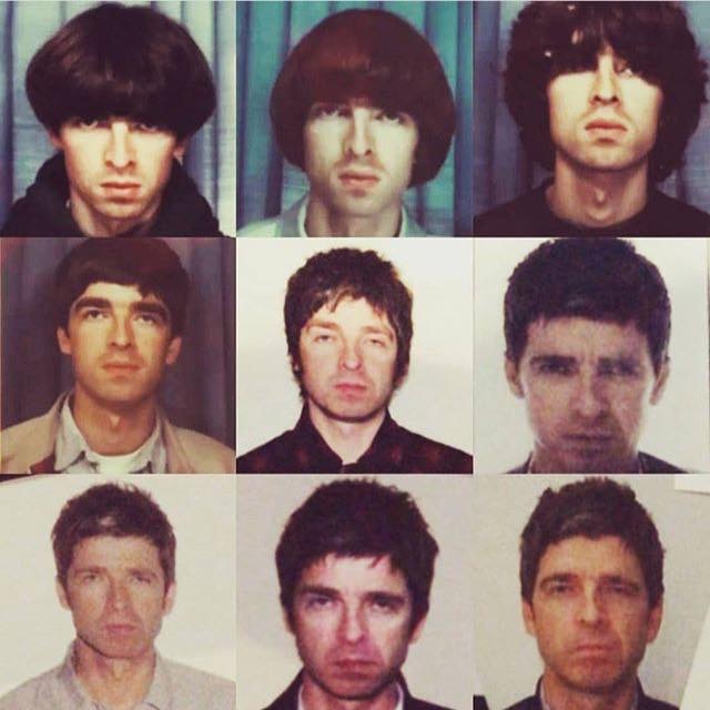 Noel Gallagher Hair noel-gallagher-hair
