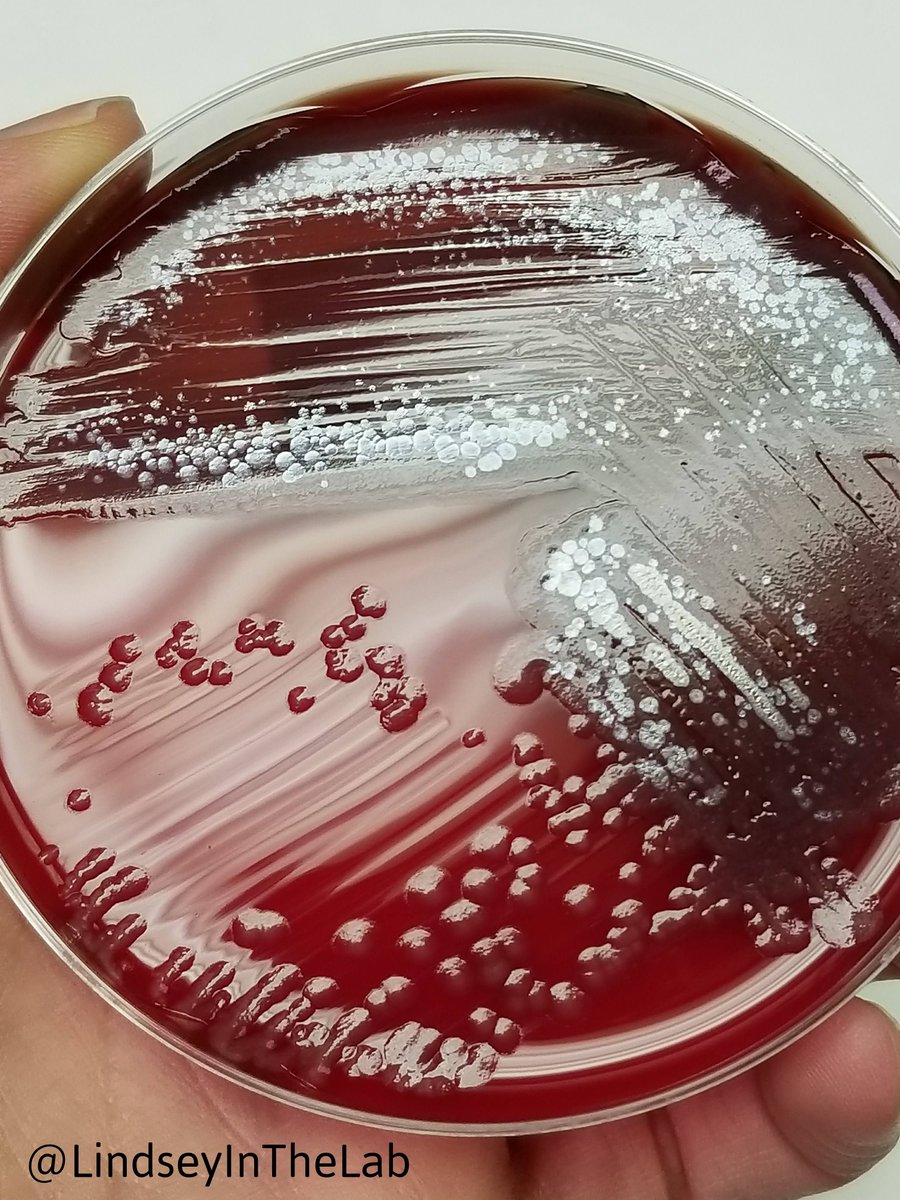 LindseyintheLab's tweet photo. At the risk of fueling the controversy, what do you smell when you see this in the micro lab? ๐
โฌ๏ธ Weigh in below!
๐๐๐ฝ๐ฌ๐งซ๐ฆ ๐จโ๐ฌ
#MedLabTwitter #ClinLab #MedMicro #Bacteria #ScienceIsPretty #Lab4Life #SmellsLikeGrapes #IamASCLS https://t.co/IHeMNz2Fjm