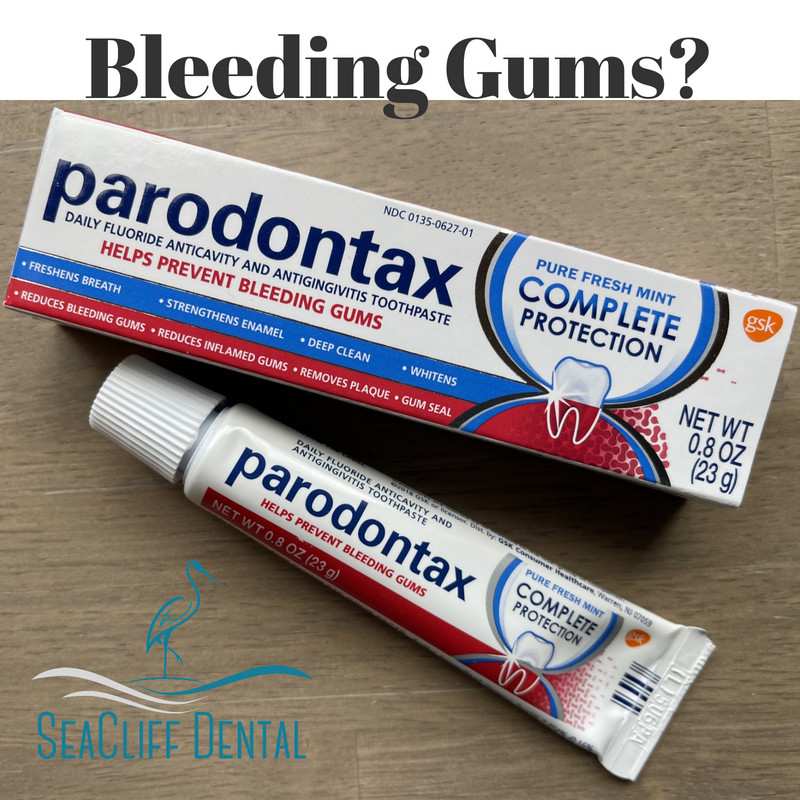 SeaCliffSF's tweet photo. Do you suffer from bleeding gums? Try parodontax toothpaste. This toothpaste helps prevent bleeding gums. Make sure to see us for your regular dental cleaning and checkup! #parodontax #bleeding #inflamed #gums #toothpaste #dentist #SanFrancisco #SeaCliffDentalSF https://t.co/FXFINp3nC7