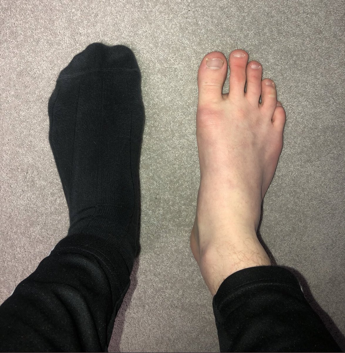 Dfootman2's tweet photo. I am bored! Which one of you FAGS is going to tribute? DM me😈 

Which one of you #subs is going to help me buy these! And see my SEXY/BIG feet in them? 💰🐷 

Cashapp - £masterdfm
PayPal - DM ME

#findom #humanatm #drain #alpha #feet @rtfindom @Unownedpiiggy https://t.co/xUgI1w5Znz