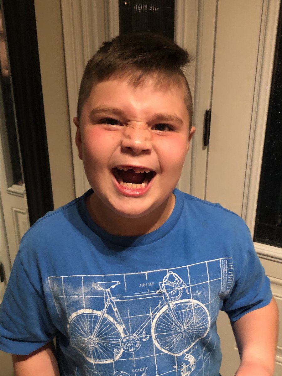 Madlertweets's tweet photo. @spittinchiclets in Milton, Ontario tonight.  First front tooth lost for the Nate Dawg.  @ryanwhitney6 @BizNasty2point0 @RearAdBsBlog @MikeGrinnell_ #NBD https://t.co/lFFnRtoc7o