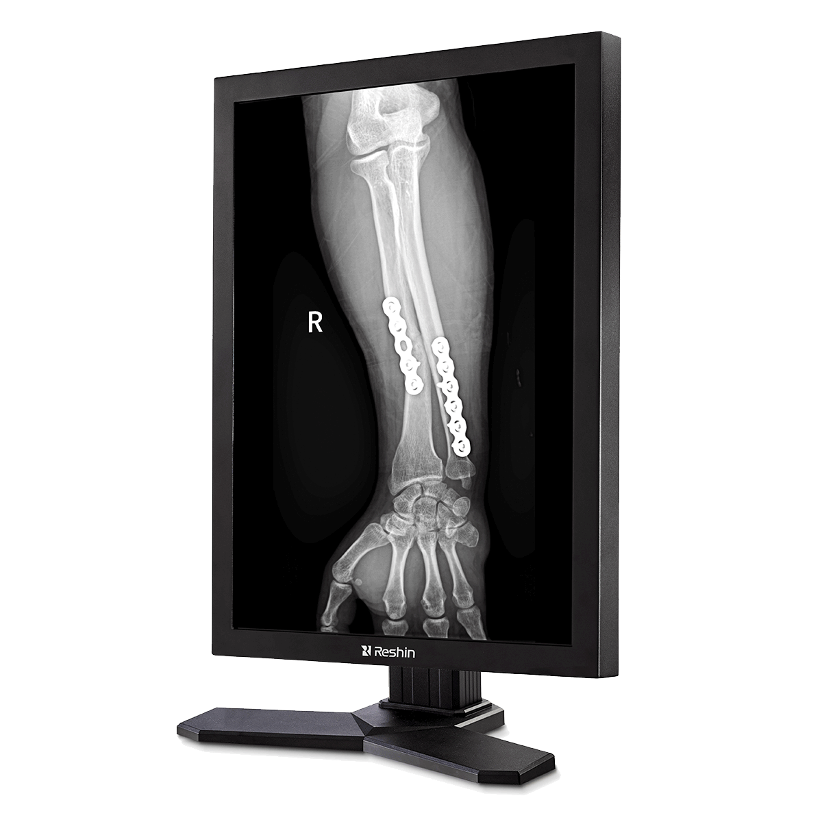 jlddisplay's tweet image. Customers can rely on the quality and longevity of our medical monitors for sale. It is made from top-quality materials. medicalmonitor.net/custom-high--r… #medicalmonitorsforsale #surgicaldisplays