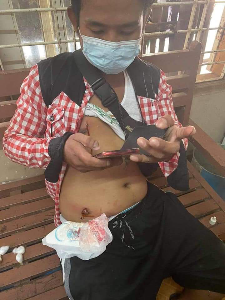 Even in the small town, Twantay, the terrorists shoot with the rubber bullet and real bullet to the protest with no mercy. And also capture above 15 people.

#WhatsHappeningInMyanmar 
#Mar12Coup