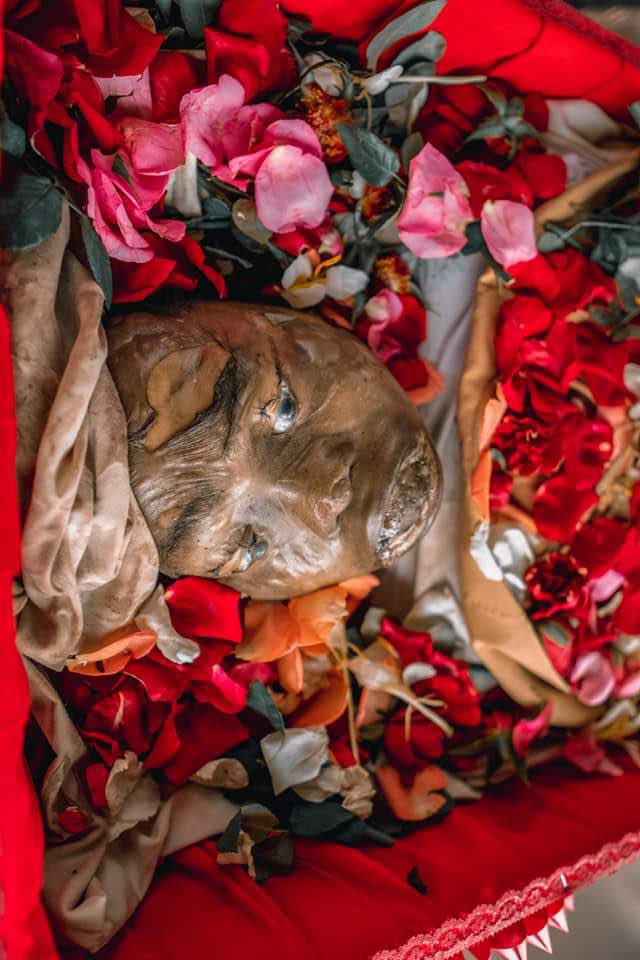 Disfigured body of U Zaw Myat Lin. He was beaten to death by military forces while he was in detention.
