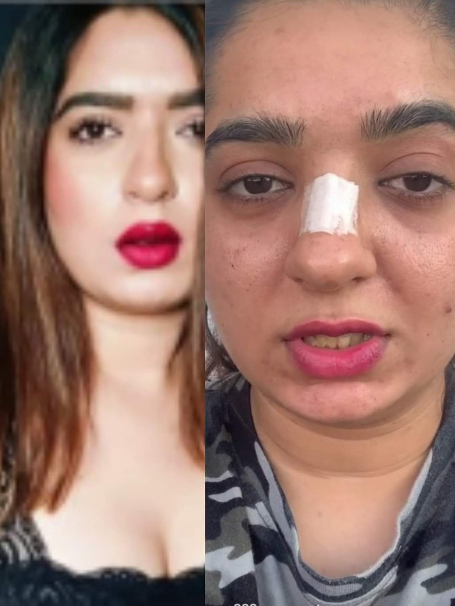 jyotiTpandey05's tweet photo. Thank you @zomatoin Boy #kamaraj for showing us real face of beauty influencer of @instagram #Hiteshachandranee https://t.co/i5btTXj38h