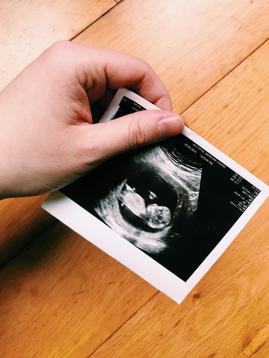 Gemma Milne tweet media