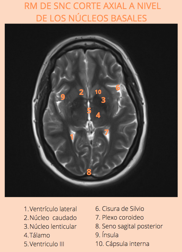 SanitariaR's tweet photo. Este trimestre hemos trabajado en clase imágenes de #resonancia 🧠
Hechas por alumn@s para alumn@s 🤩🤩🤩
#TSIDMN #anatomiaradioloxica_2021 https://t.co/2Ce9AN017J