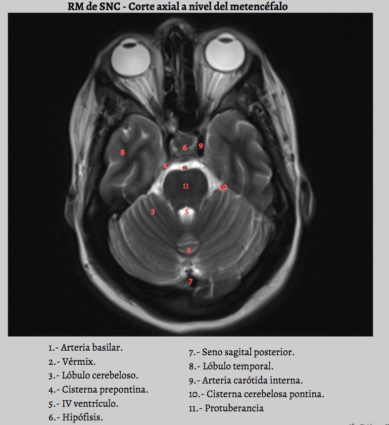 SanitariaR's tweet photo. Este trimestre hemos trabajado en clase imágenes de #resonancia 🧠
Hechas por alumn@s para alumn@s 🤩🤩🤩
#TSIDMN #anatomiaradioloxica_2021 https://t.co/2Ce9AN017J