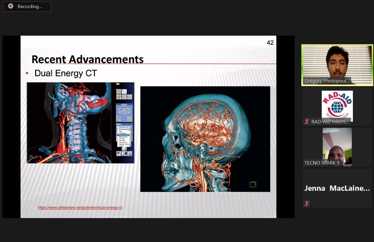 Last week, RAD-AID Tanzania kicked-off a series on CT Basic Principles to best support #RadiologicTechnologists in #Tanzania. We thank Gregory Photopoulos and Jenna MacLaine for volunteering their time and expertise.