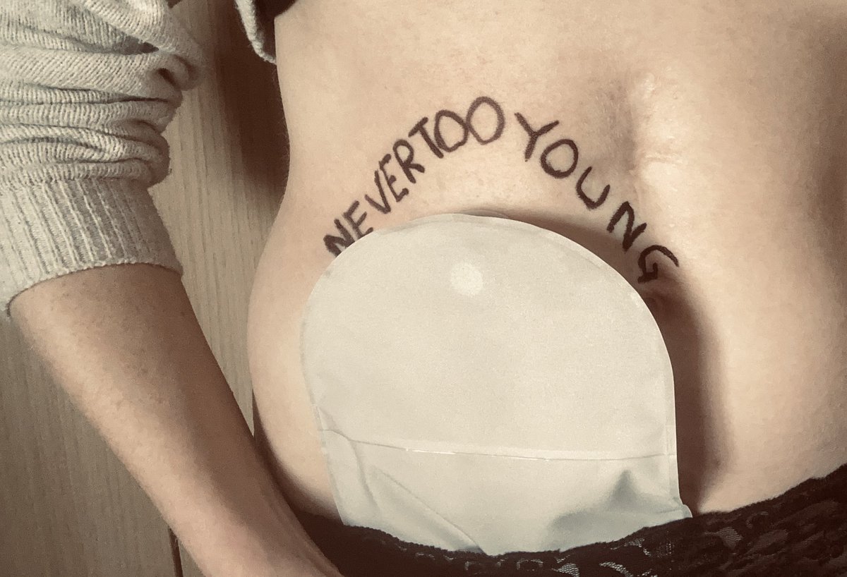 4 years ago I got my cancer diagnosis 

More than 2,500 people under the age of 50 are diagnosed with #bowelcancer each year

If you experience the symptoms pls speak to your GP 

• bleeding • change in bowel habits • lump • unexplained tiredness &amp; weightloss • #never2young