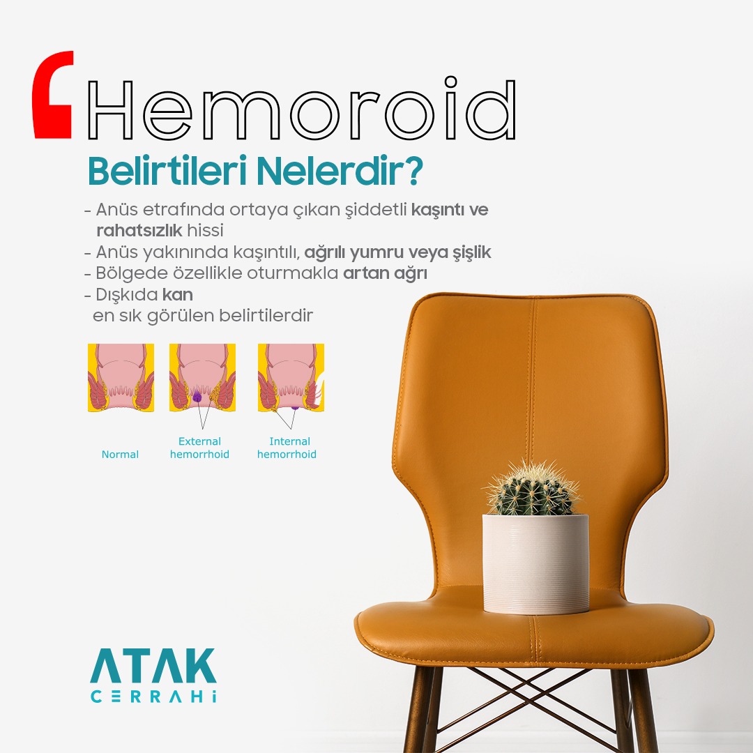 Hemoroid hastalığın yerleşim yerine ve evresine göre hemoroid belirtileri değişiklik göstermektedir.
Hemoroid hastalarının farklı semptomlardan şikayetleri olabilmektedir.

#Hemoroid #Basur #HemoroidBelirtileri #HemoroidTedavisi #HemoroidAmeliyatı #Lazer #GenelCerrahi