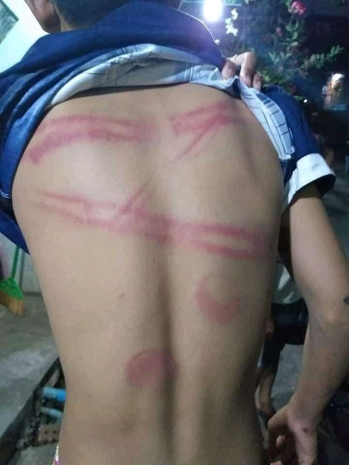 JoPixy1988's tweet photo. CHILD TORTURE, CHILD ABUSE 
He just only 15 years old. This morning he went out &amp; buy snacks but Police grabbed &amp; attested him. They released him this evening but he was beaten &amp; kicked violently by Military terrorists. 
#WhatsHappeningInMyanmar #Mar12Coup #CrimesAgainstHumanity https://t.co/Tr4mZm8ZIy