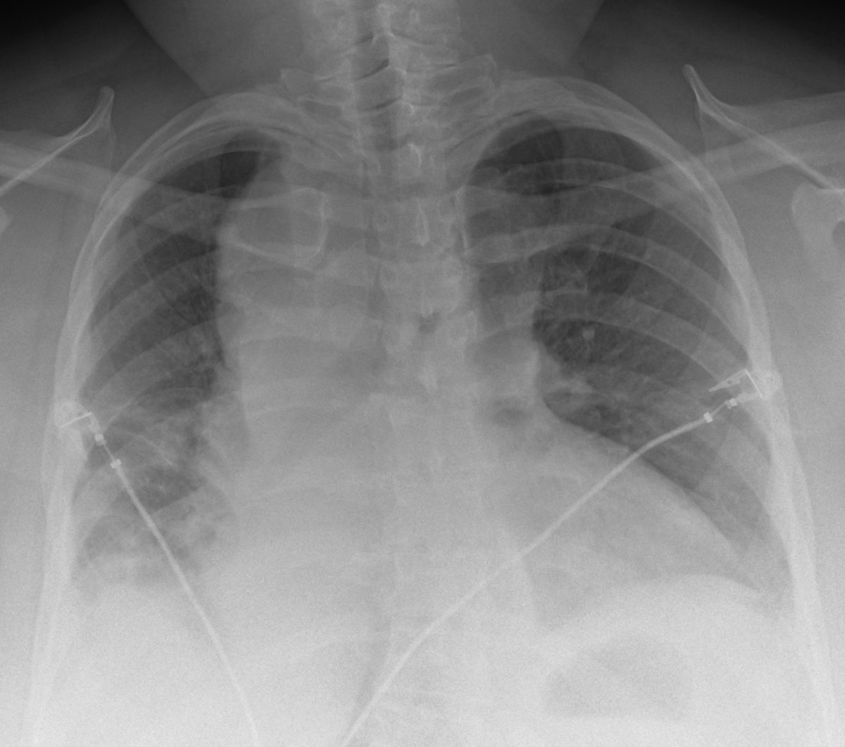 Blake Briggs, MD tweet media