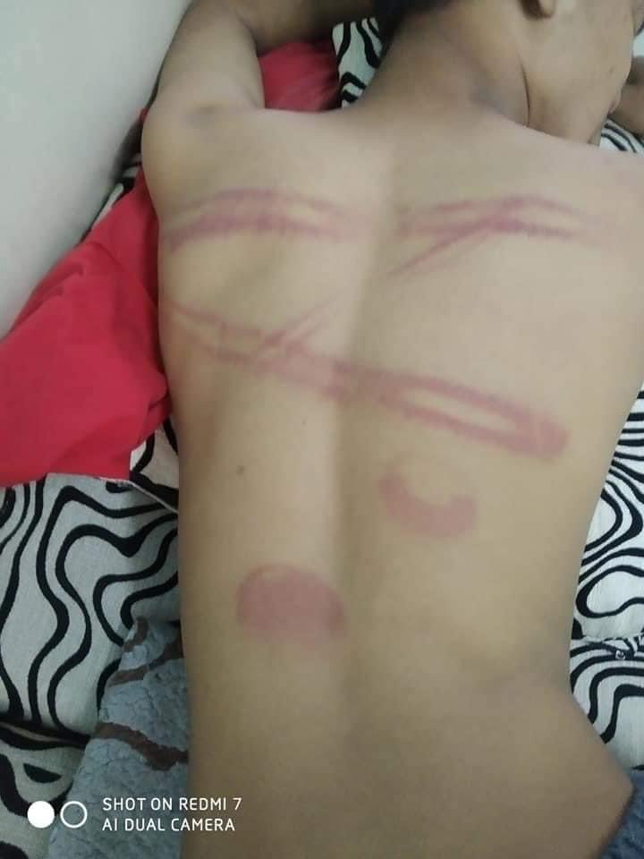 maytoekhine's tweet photo. 15 year old who got arrested today just released but with injuries on several parts of his body. No consideration for a child who will now suffer from a lifelong trauma. Who will stop this CHILD ABUSE? @SavetheChildren @UNICEF @YourAnonCentral @UNHumanRights https://t.co/AxW1wVKX9A