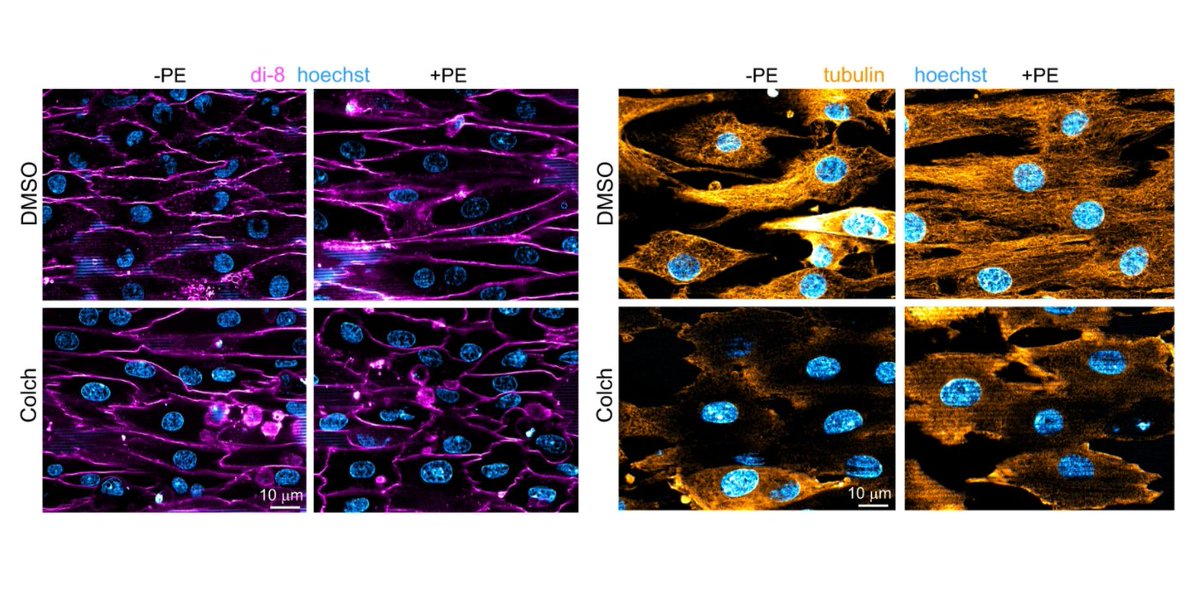 Scientists from @PennMedicine found that the microtubule motor Kinesin-1 distributed mRNAs and ribosomes along microtubule tracks to discrete domains within the #cardiomyocyte. 💗 @NatureComms: go.nature.com/3td9SZq