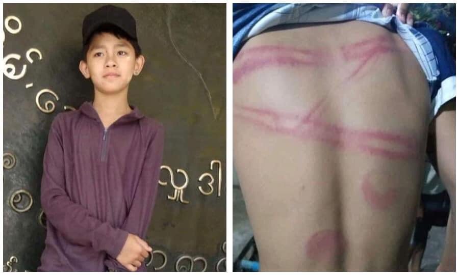 This 15 years old little boy was kidnapped by Military Terrorists while he was going to buy snacks.This underage kid was severely beaten and assaulted while being detained.This is CHILD ABUSE.Imagine the pain and fear he had to suffer. #WhatsHappeningInMyanmar #Mar12Coup