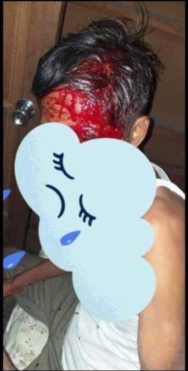Su_Mon2001's tweet photo. TW // Graphic Content
Situation in Mogok is still intense!Military Terrorists raiding inside th houses and destroy the civilians' properties, beating the people &amp; arresting the night guards!No: of arrested people still cannot confirmed yet!
#Mar12Coup
#WhatsHappeningInMyanmar https://t.co/y5Hlp5MOwb