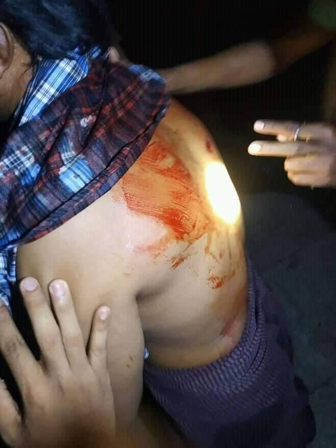 46 Ward, North Dagon, Yangon — one civilian as #Myanmar security forces shot with rubber bullets.

#WhatsHapppeningInMyanmar #MilkTeaAlliance #Mar12Coup