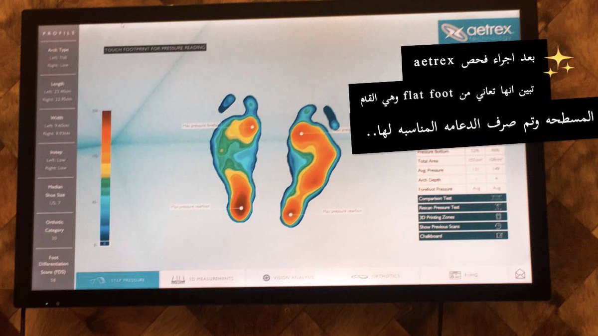 Footcomfort2's tweet photo. فحص بصمة القدم للكشف عن عدة حالات:
♦️مواقع الضغط في باطن القدم لمرضى السكري
♦️تجنب جروح القدم السكري بإكتشاف مناطق الضغط. 
♦️حالات آلام الظهر,الركبة, باطن القدم أثناء المشي
♦️القدم المسطحه Flat foot
♦️القوس العالي High Arch
شعارنا أقدام صحية لحياة أفضل
 #الطايف_الان https://t.co/TwcpHSgVG0
