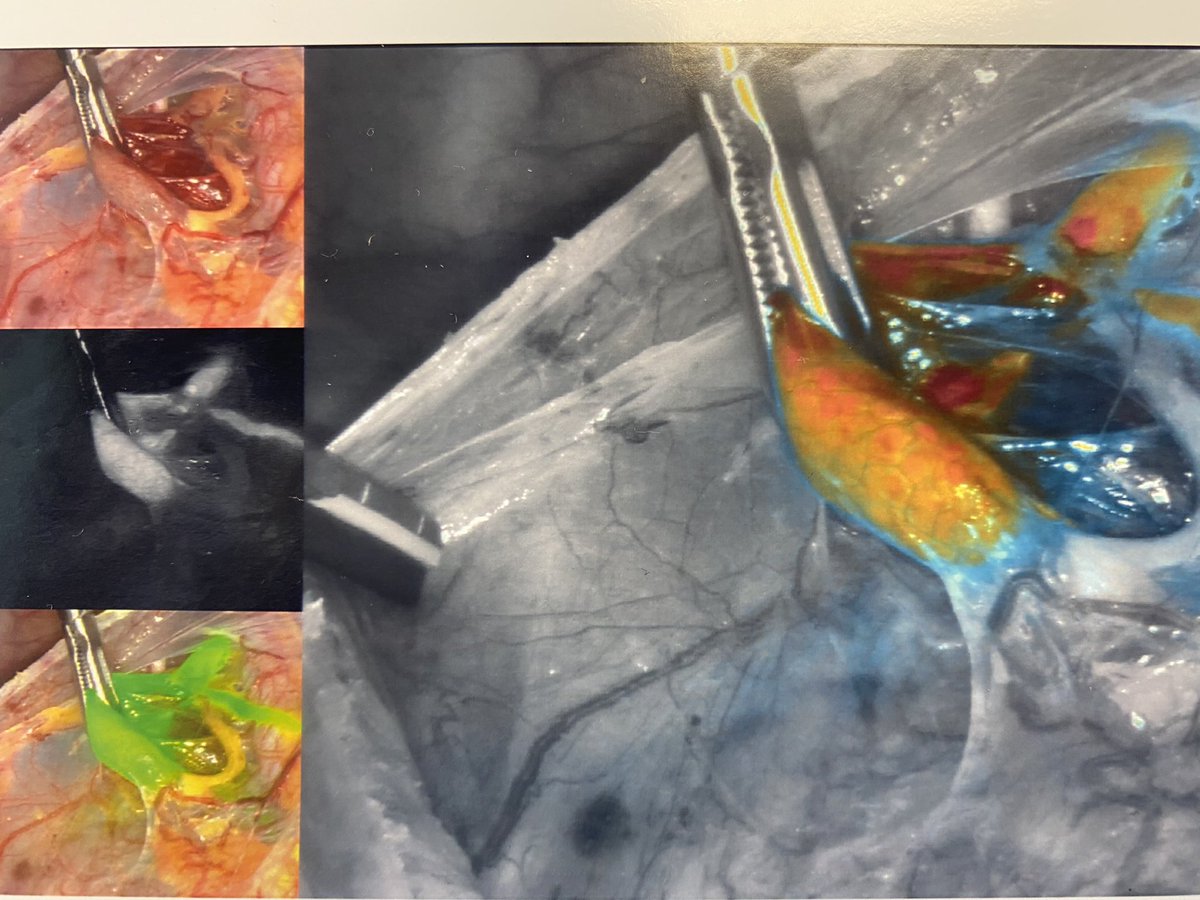 pedroramirezMD's tweet photo. Always a beautiful site! #SLN @IJGCfellows @IJGConline @ESGO_society @IGCSociety https://t.co/A7iBbD8L07